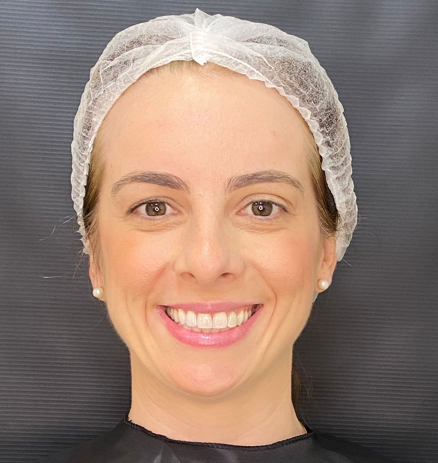 toxina botulínica e Estética